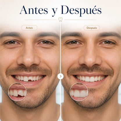 DentFix | Residen Dental Moldeable