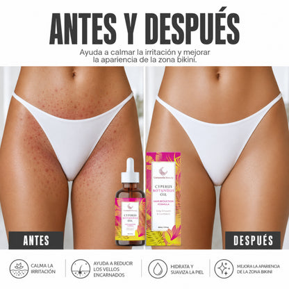 Cyperus | Aceite Inhibidor de Vello e Irritación